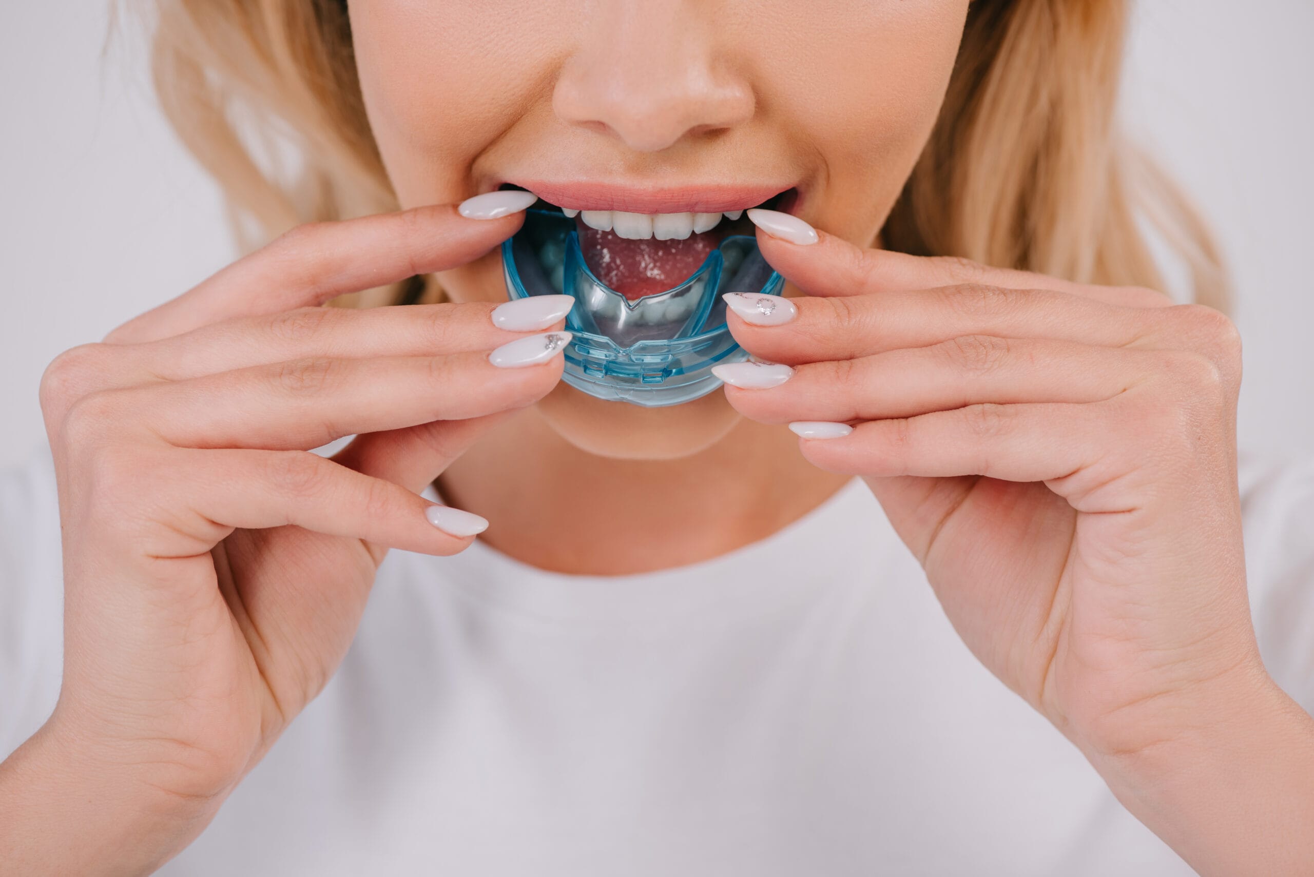 cropped view of woman putting on orthodontic trainer dental braces isolated on white