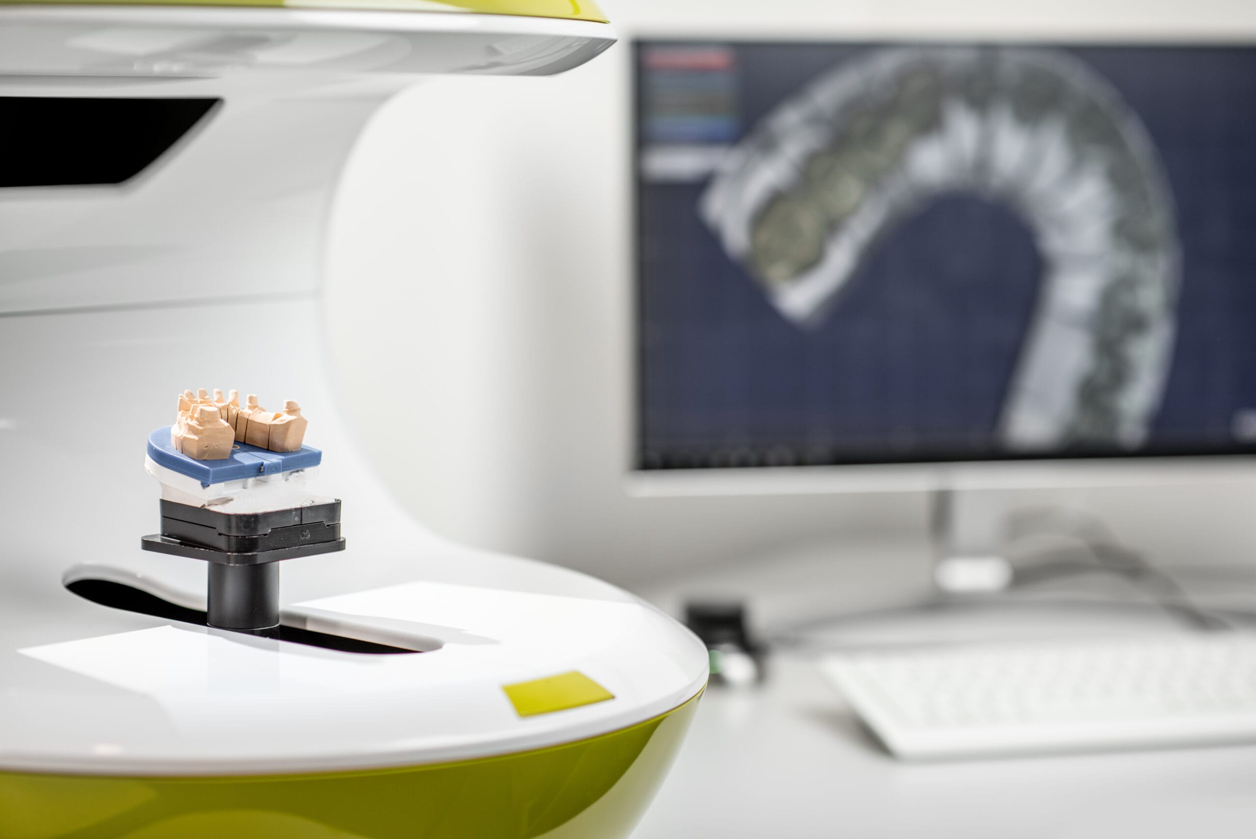 Scanning jaw model on the 3rd scanner at the lab Dentist showing clear aligners on artificial human jaw presenting innovative teeth correction