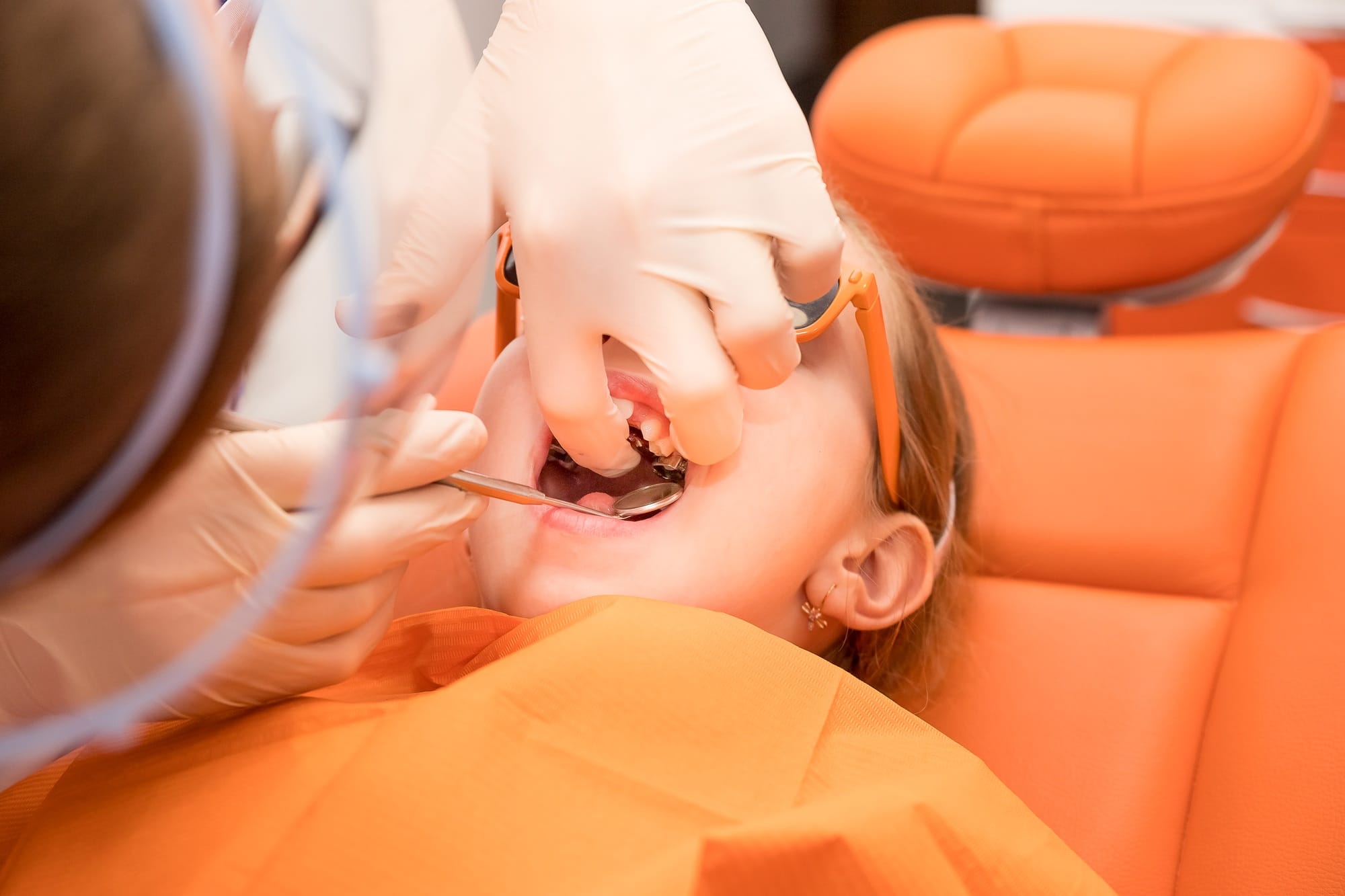 Dental plate. Expansion of the jaw in a child. teenage girl holding an orthodontic plate in her Dental plate. Expansion of the jaw in a child. teenage girl holding an orthodontic plate in her