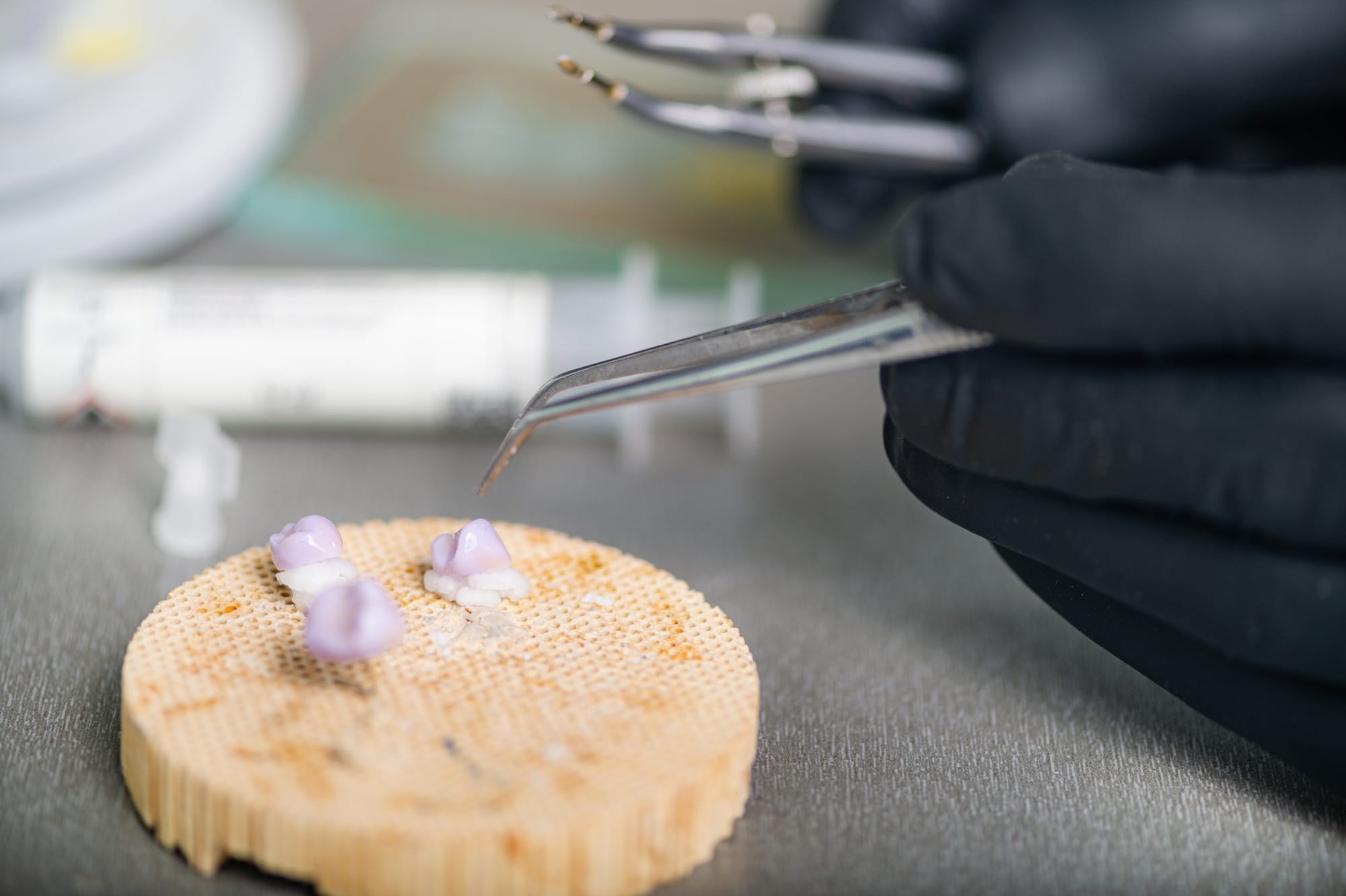 Teeth Prosthodontics. Teeth Crowns Prepared for Oven and Press. Teeth Prosthodontics. Teeth Crowns Prepared for Oven and Press.
