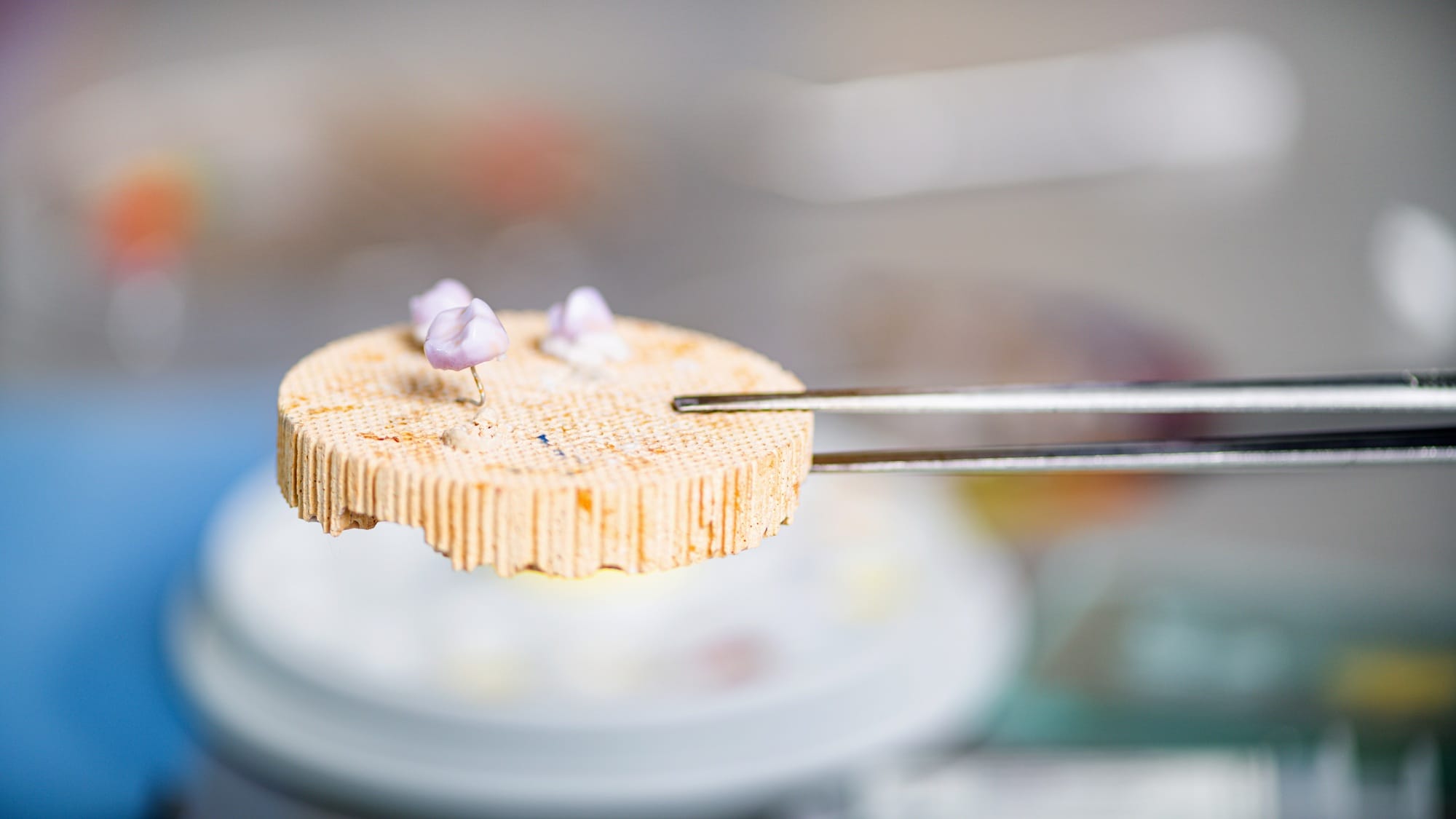 Teeth Prosthodontics. Teeth Crowns Prepared for Oven and Press. Teeth Prosthodontics. Teeth Crowns Prepared for Oven and Press.