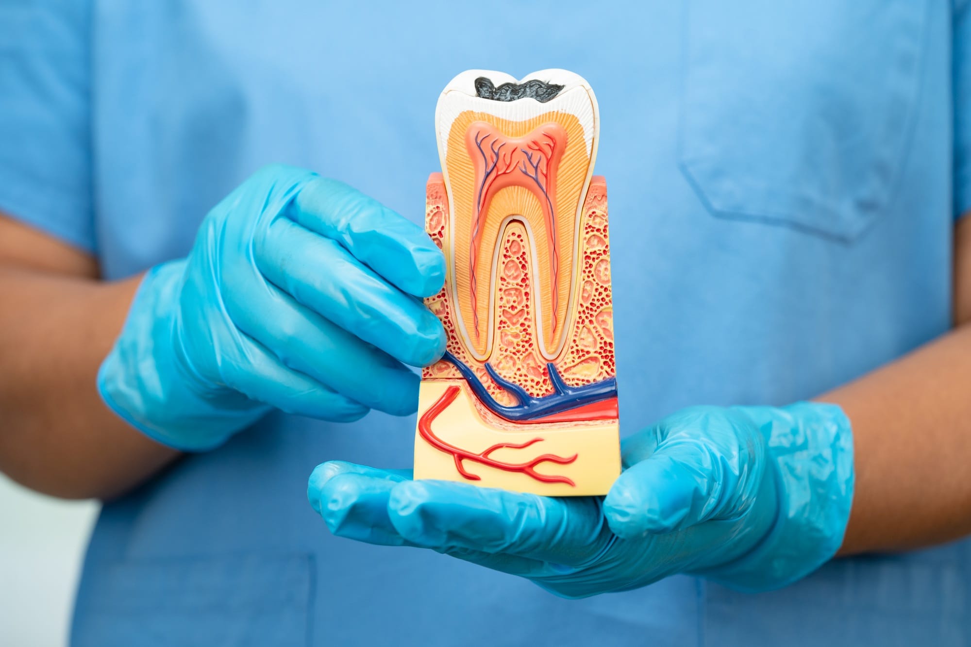 Asian dentist holding dental implant, artificial tooth roots into jaw, root canal of dental Asian dentist holding dental implant, artificial tooth roots into jaw, root canal of dental