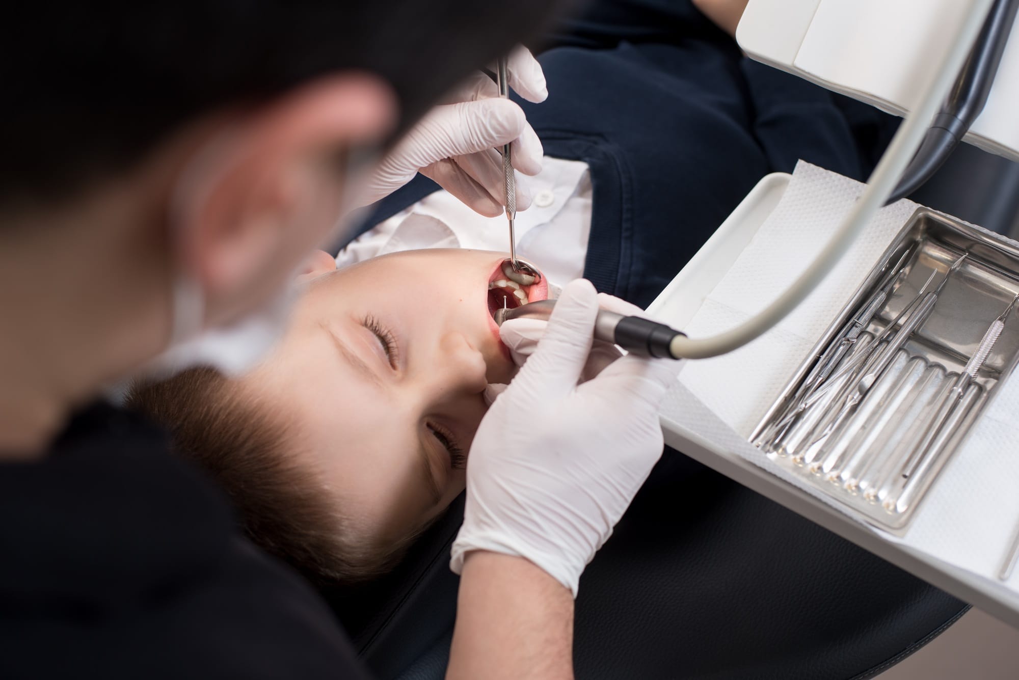 Boy with open mouth during drilling treatment at the pediatric dentist in dental clinic Boy with open mouth during drilling treatment at the pediatric dentist in dental clinic