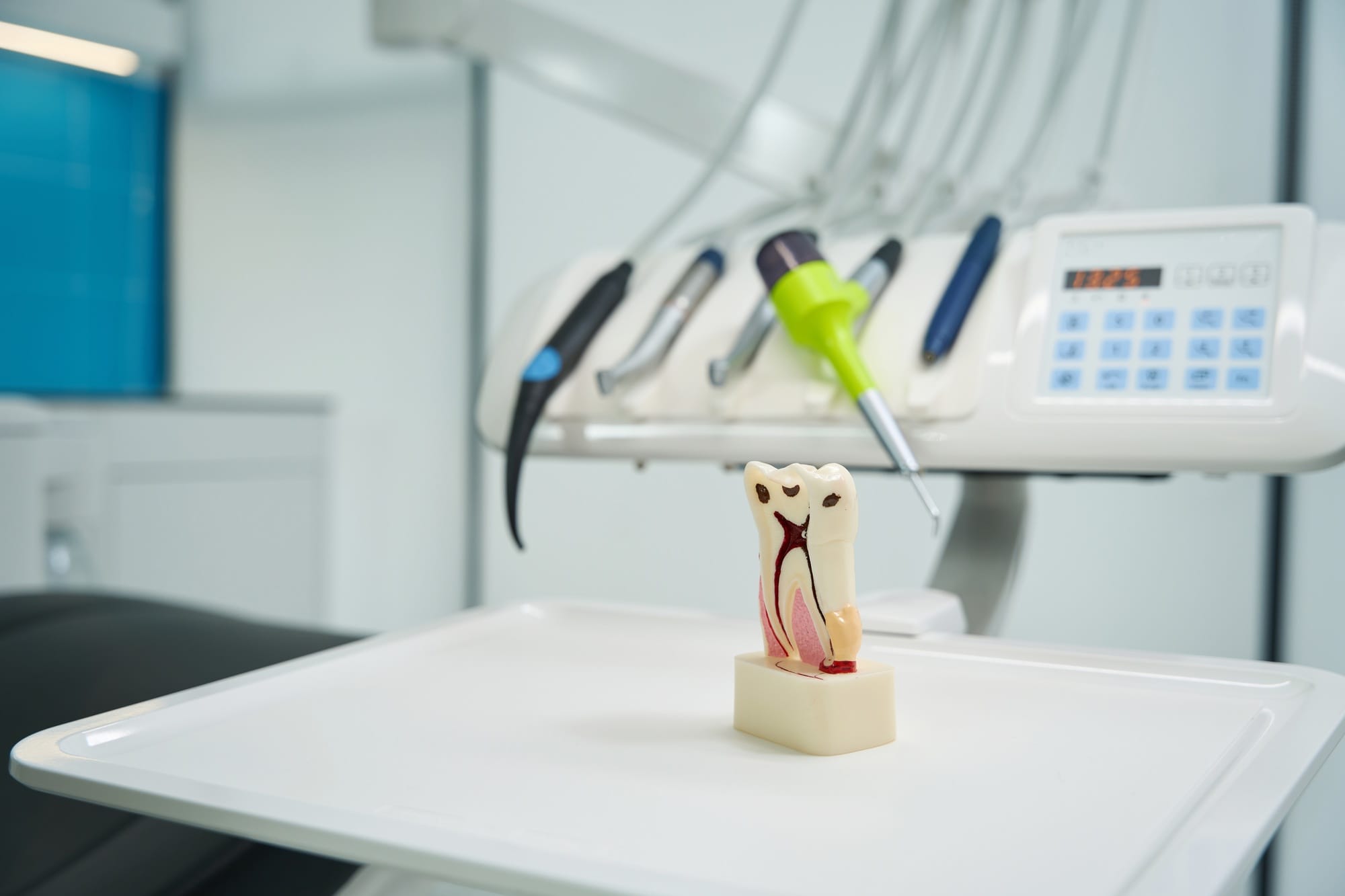 Close-up of tooth model with root canals and caries Close-up of tooth model with root canals and caries