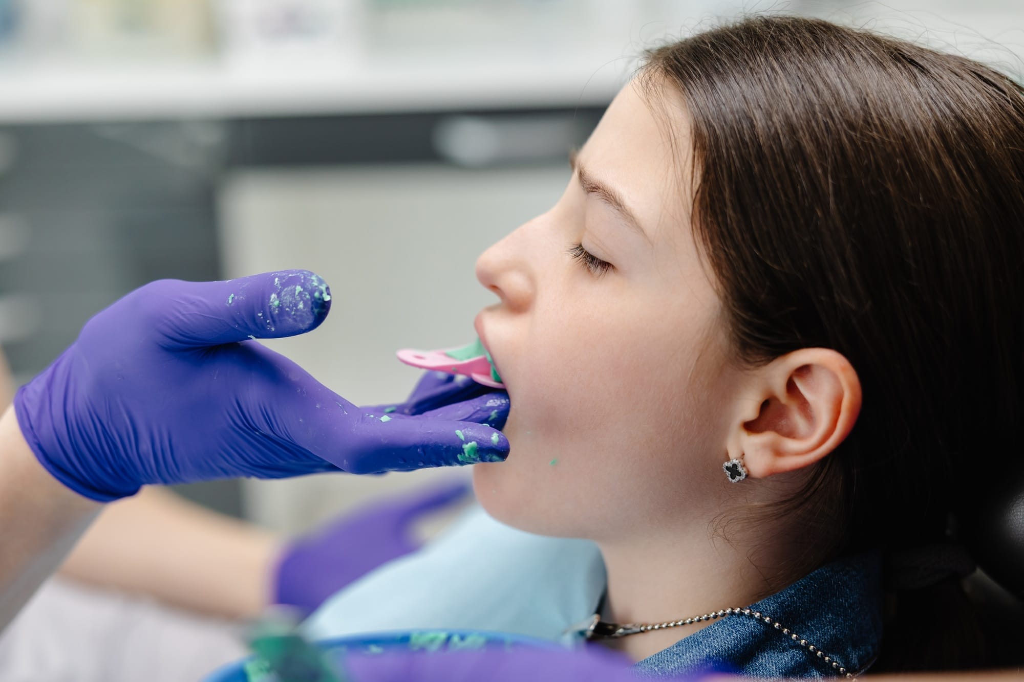 Dentist applying dental sealant on teeth of teenage girl Dentist applying dental sealant on teeth of teenage girl