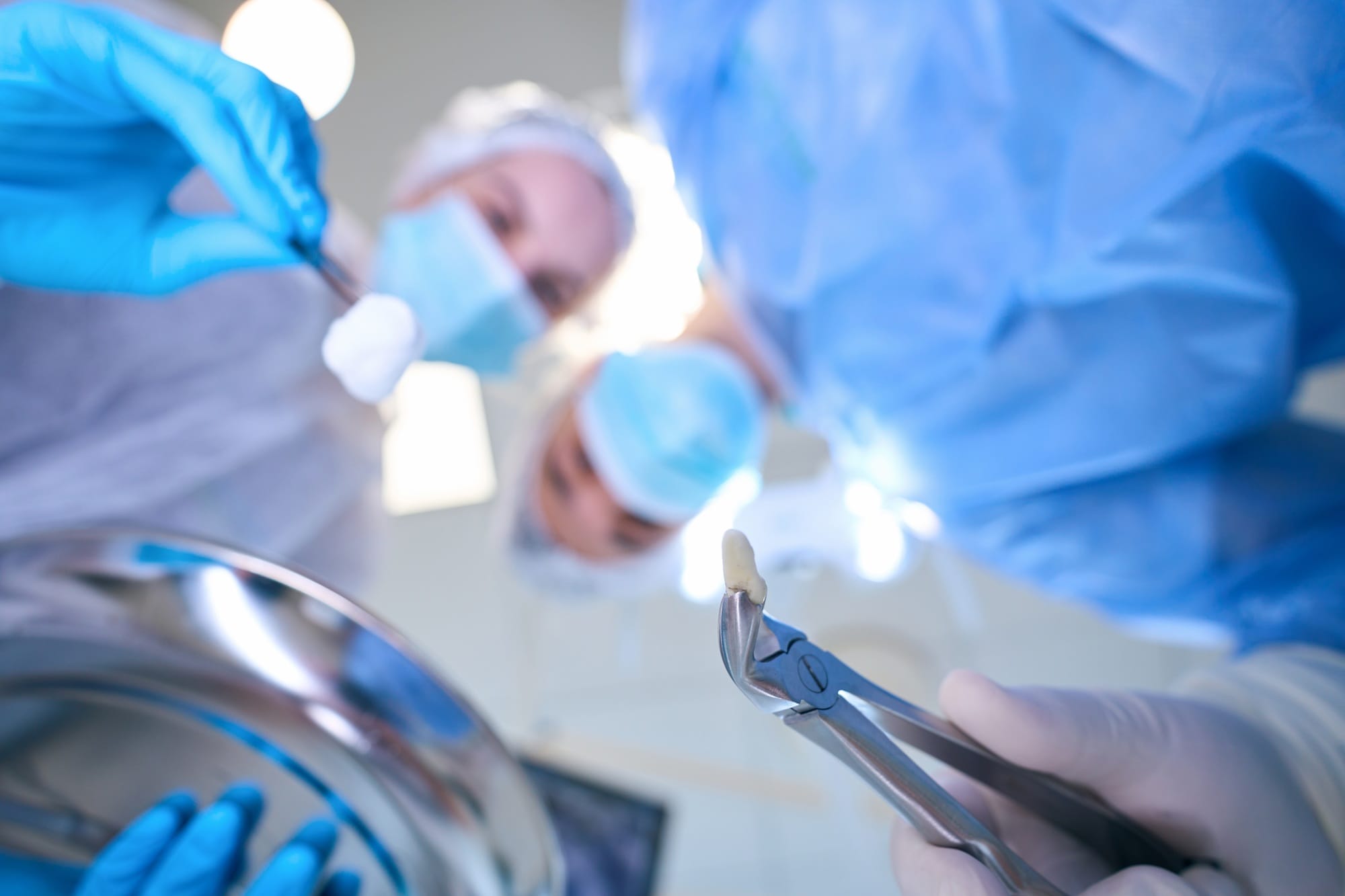 Male surgeon holds forceps with tooth removed in his hands Male surgeon holds forceps with tooth removed in his hands