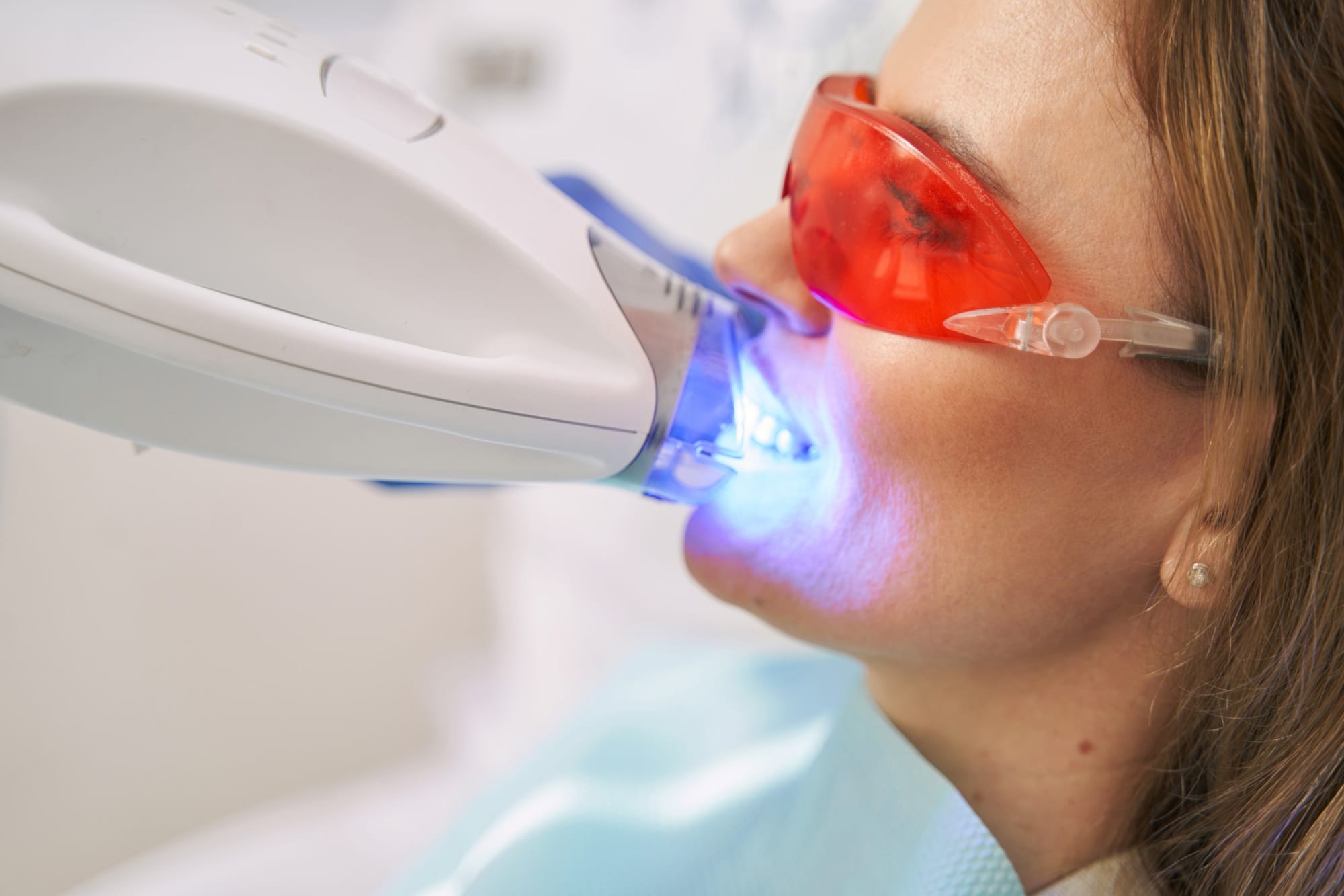 Woman having laser teeth whitening procedure in stomatology clinic Woman having laser teeth whitening procedure in stomatology clinic