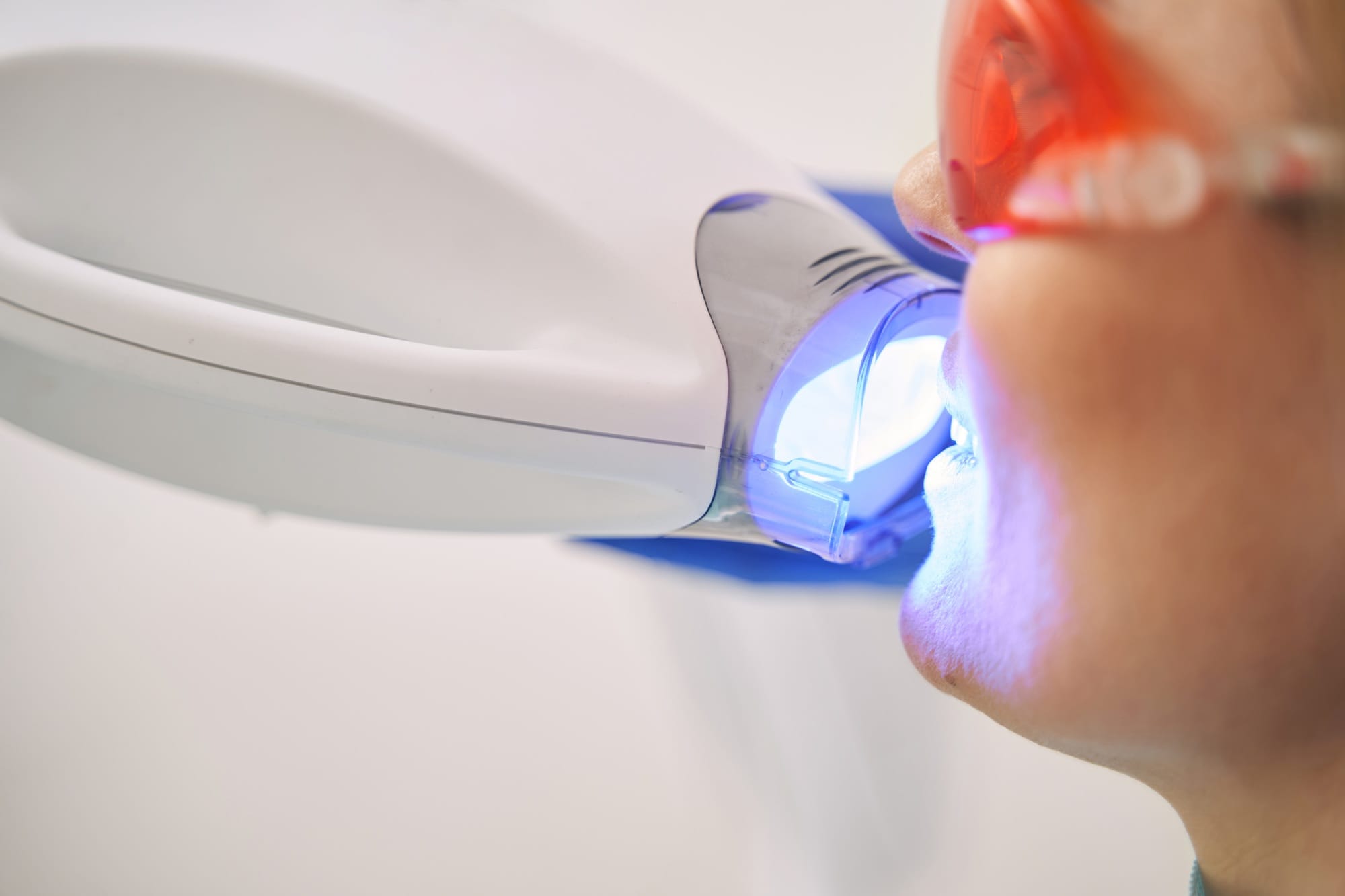 hard tissue laser hard tissue laser