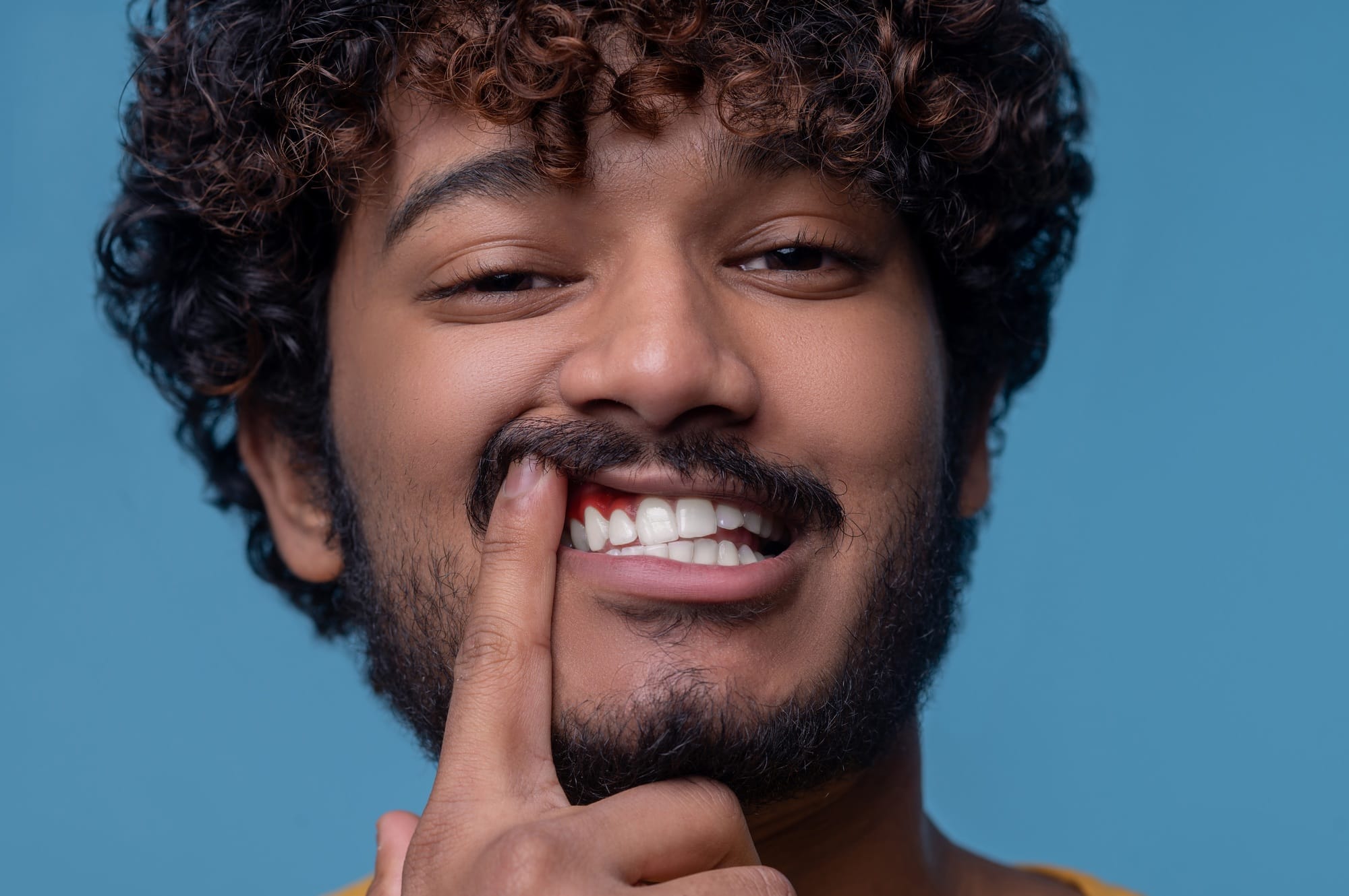 Young Indian man showing his inflamed gums Young Indian man showing his inflamed gums