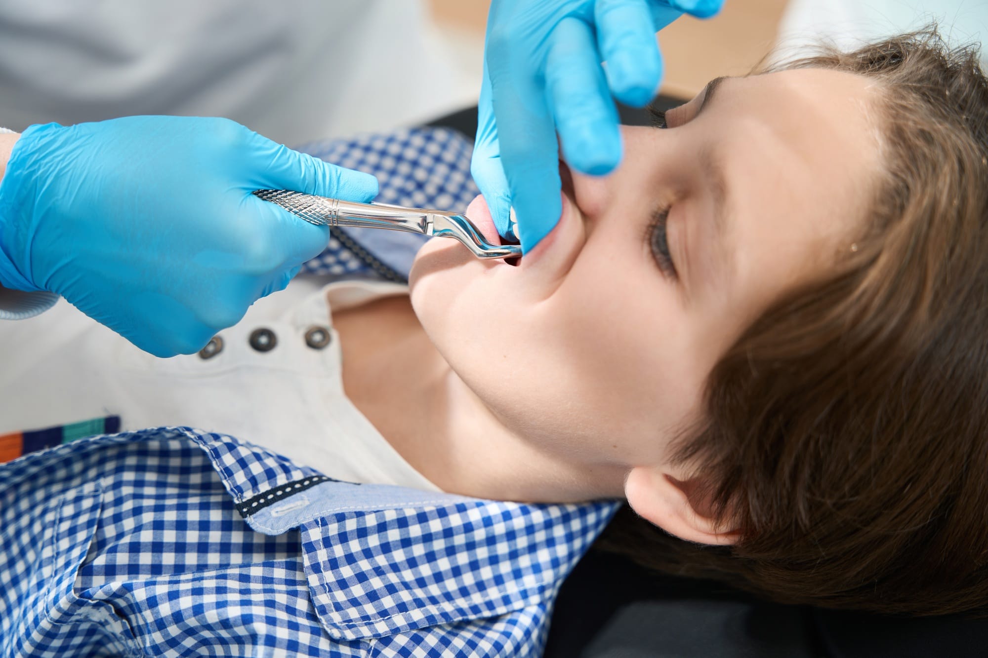 Boy is having a tooth removed in a dental clinic Boy is having a tooth removed in a dental clinic