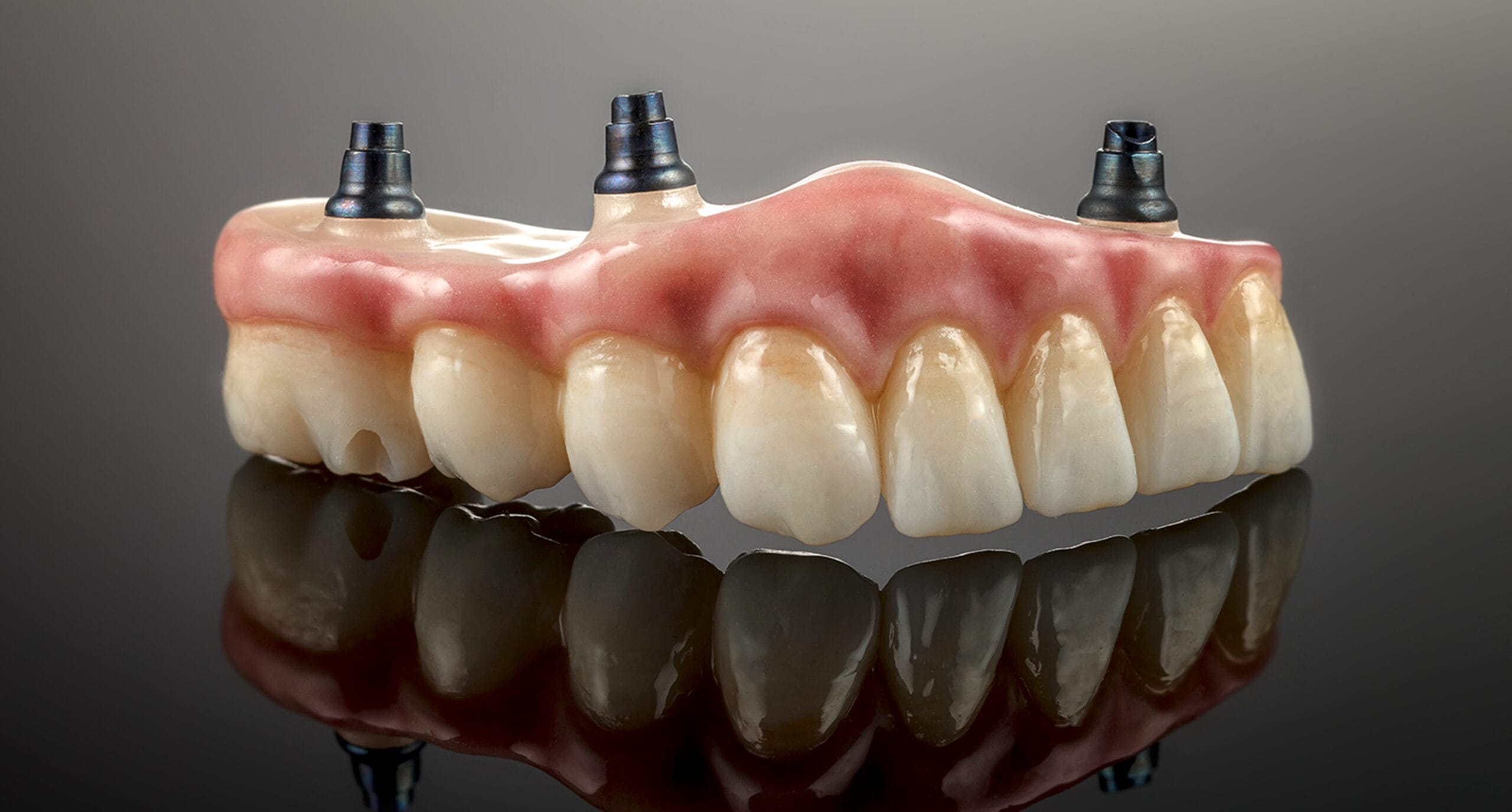 Dental professional explaining dental implant crown on teeth model, guidance on dental implant care