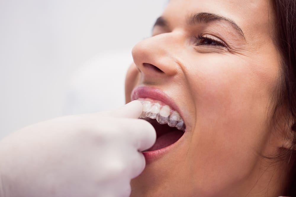 Invisalign in Lawrenceville