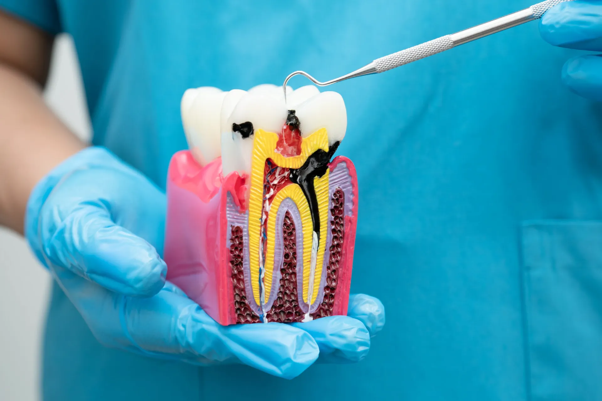 asian-dentist-holding-dental-implant-artificial-t-2025-02-25-22-42-29-utc-scaled