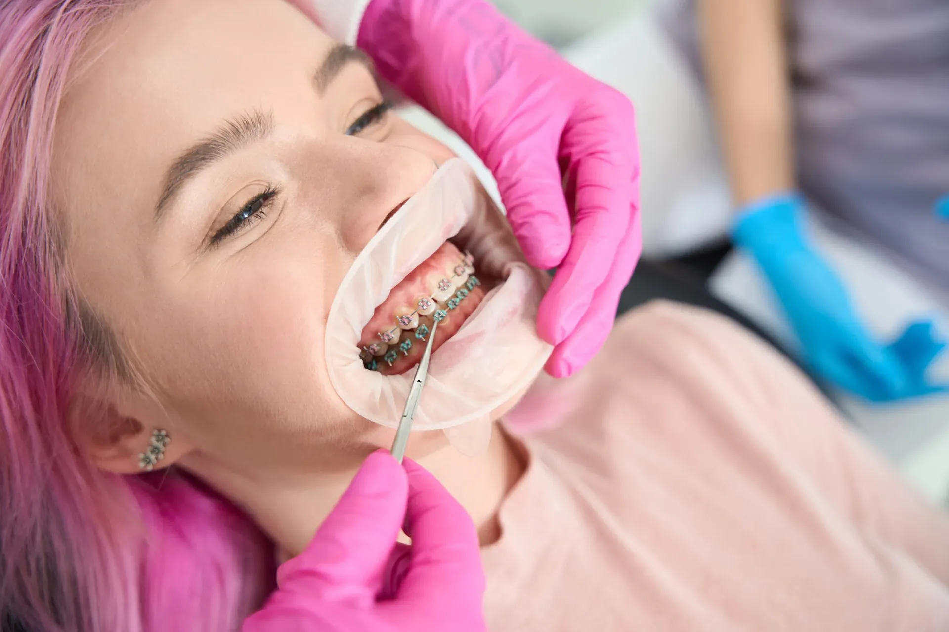 orthodontist-checks-the-system-for-the-correction-2024-10-18-09-42-48-utc-scaled (1)