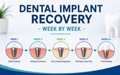 Dental Implant Recovery – Week by Week